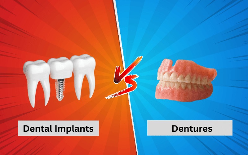 dental implant vs denture